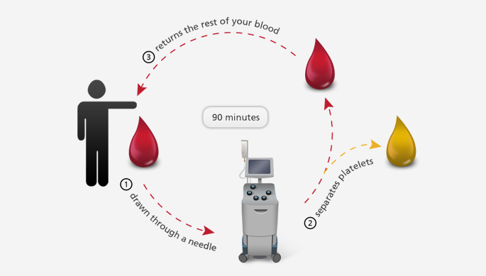 platelet donation process image